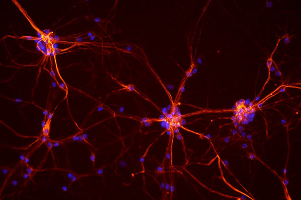 Healthy Mouse Spinal Cord Neurons