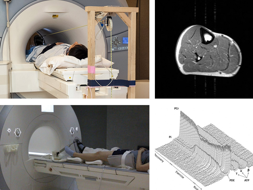 Magnetic Resonance Imaging and spectroscopy